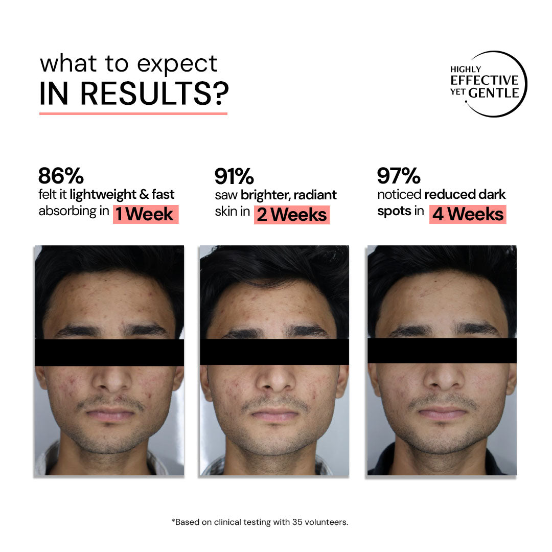 Dark Spot Clearing Serum with Liposomal Technology | 5% Niacinamide & 2% Alpha Arbutin | Clinically Tested