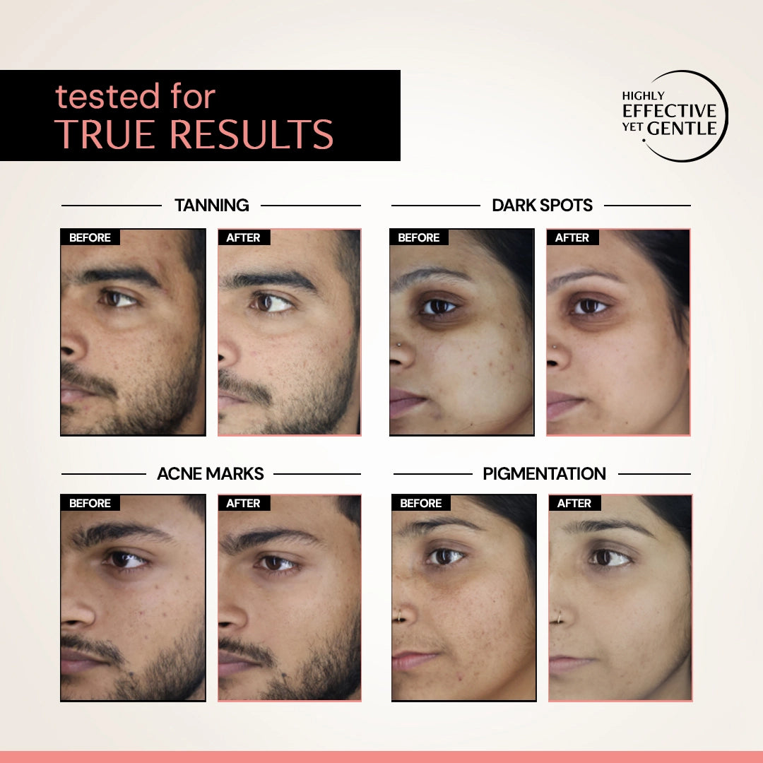 Clearing Serum with 5% Niacinamide & 2% Alpha Arbutin| 4-in-1 Multi-Benefit | Clinically Tested