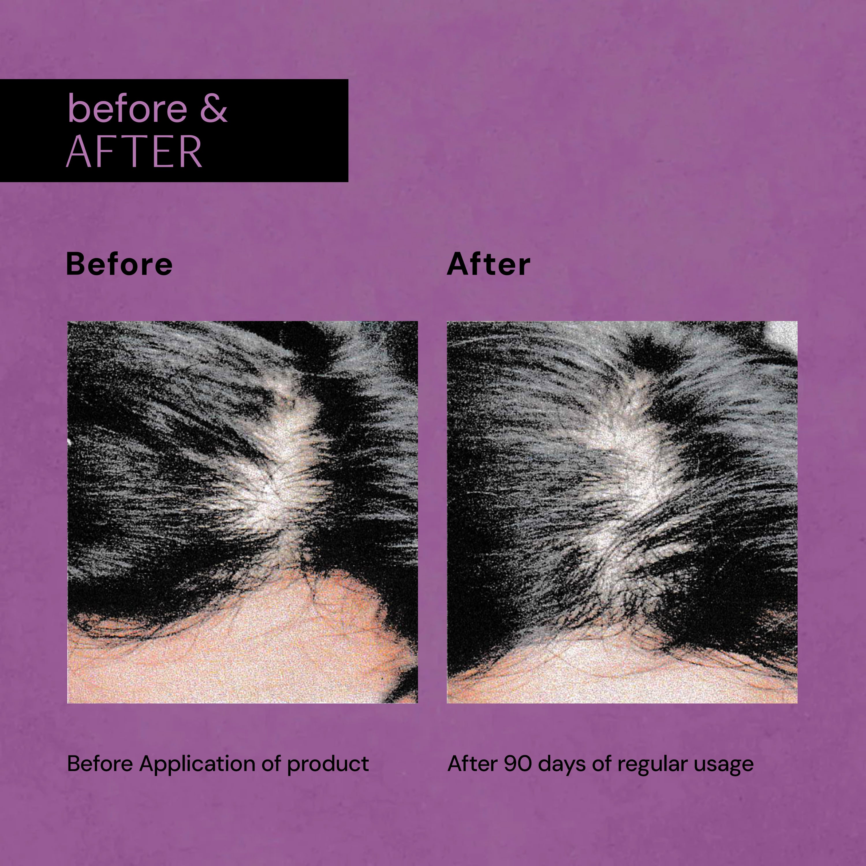 Hair Growth Serum with Rosemary, Anagain & Peptide Complex