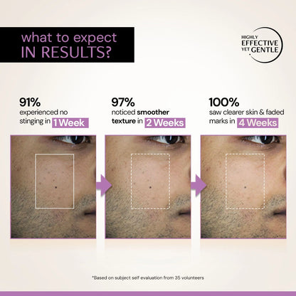 Exfoliating AHA BHA PHA Serum with Liposomal Technology