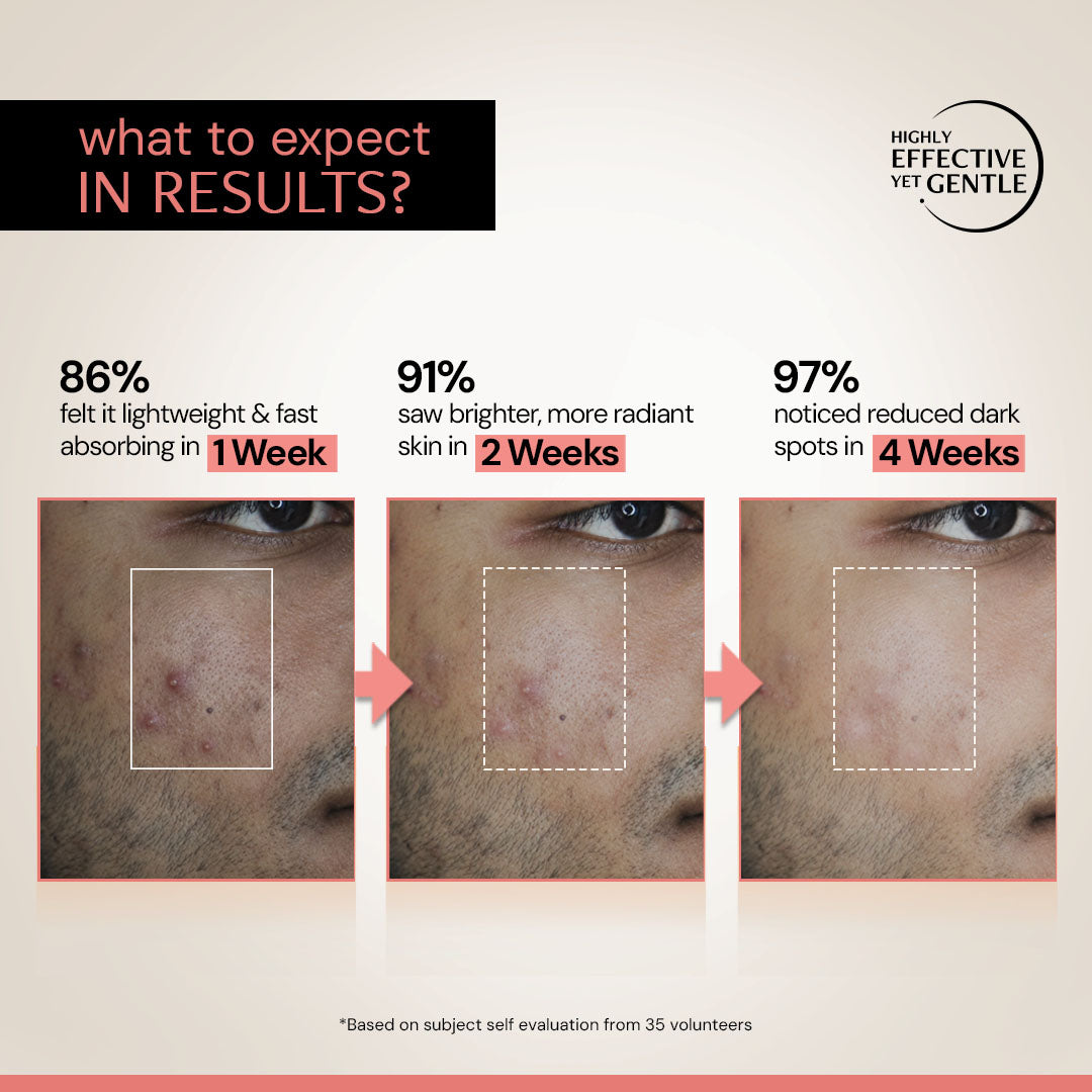 Dark Spot Clearing Serum with Liposomal Technology | 5% Niacinamide &amp; 2% Alpha Arbutin | Clinically Tested