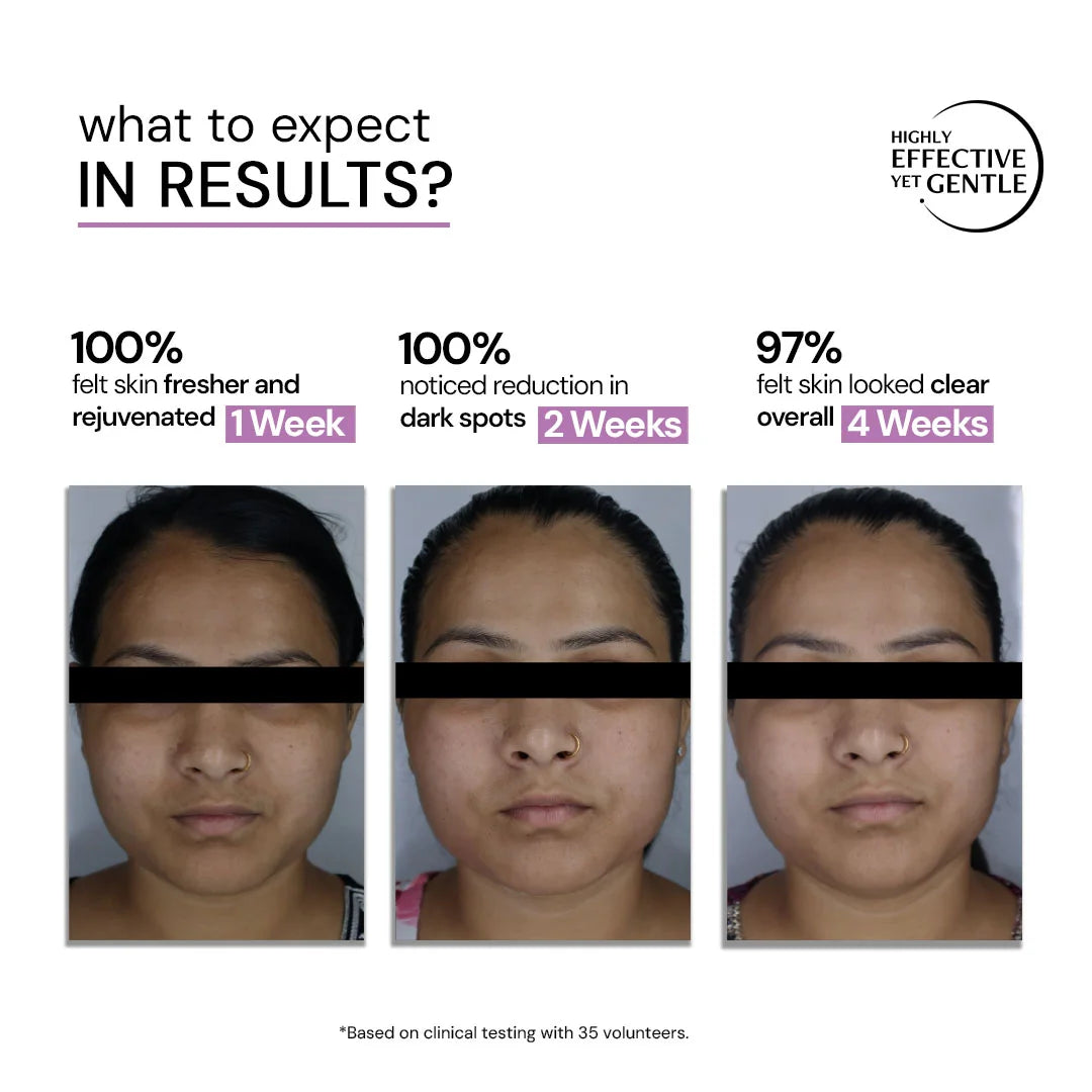 Exfoliating AHA BHA PHA Serum with Liposomal Technology