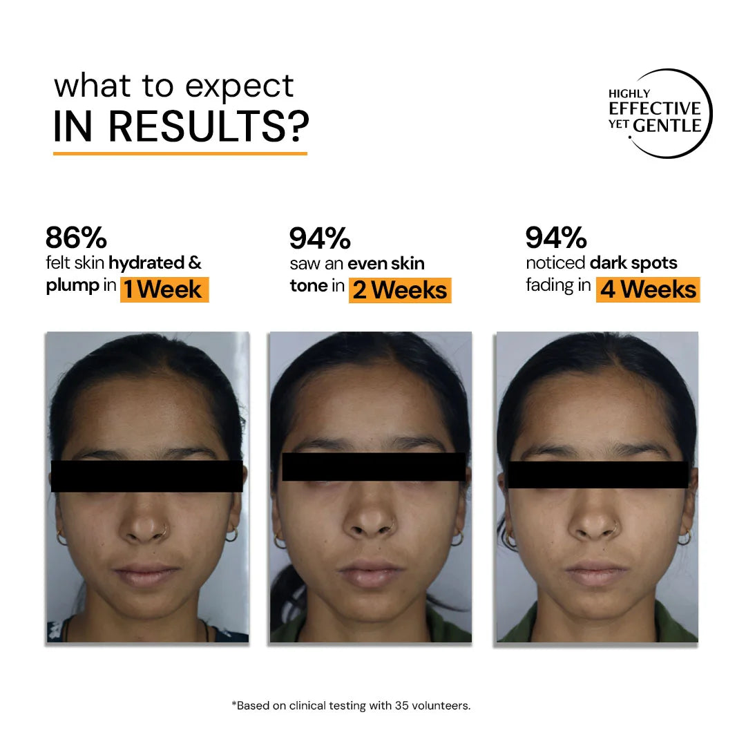 10% Vitamin C Serum for Glowing Skin with Liposomal Technology | Clinically Tested