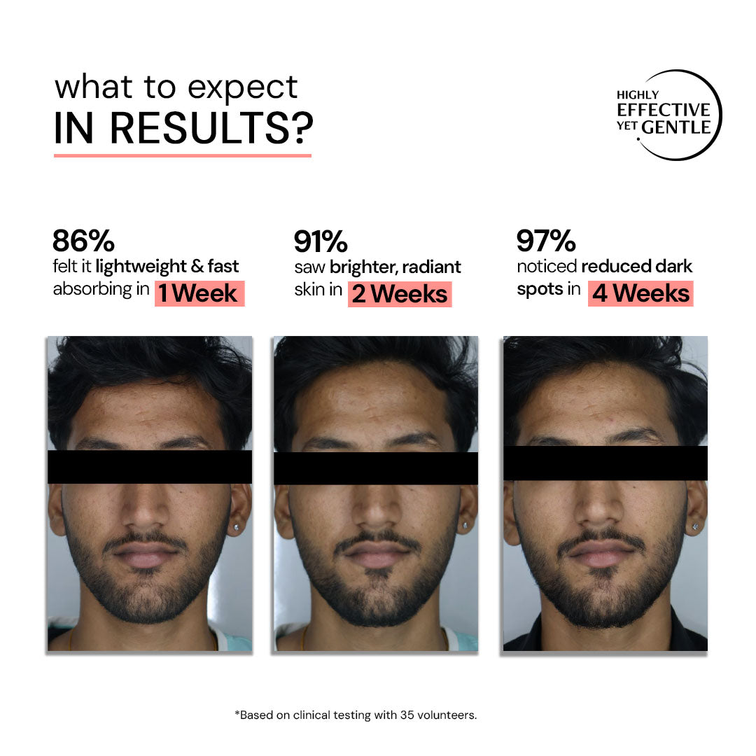 Dark Spot Clearing Serum with Liposomal Technology | 5% Niacinamide &amp; 2% Alpha Arbutin | Clinically Tested