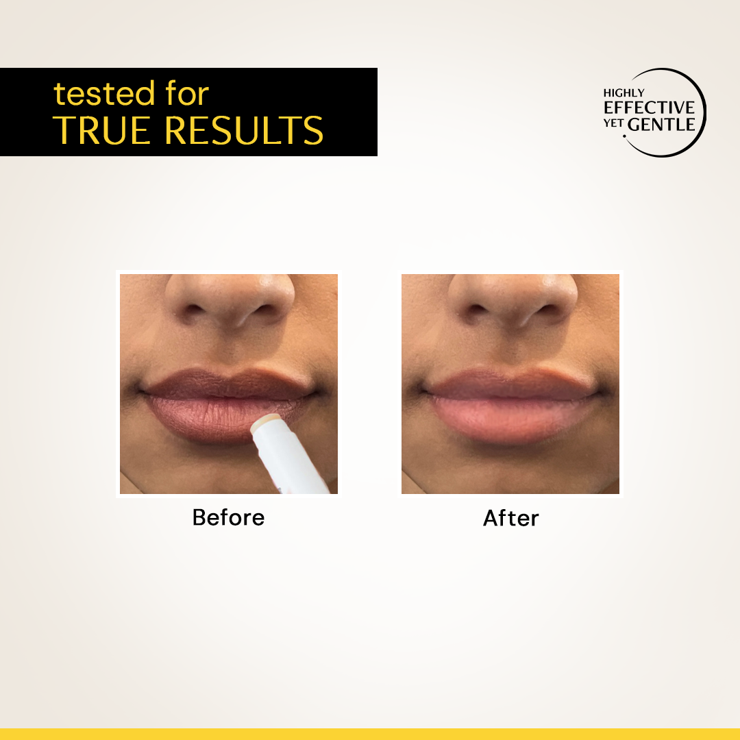 Brightening Lip Balm with SPF 50 - 1% Vitamin C + 0.1% Resorcinol