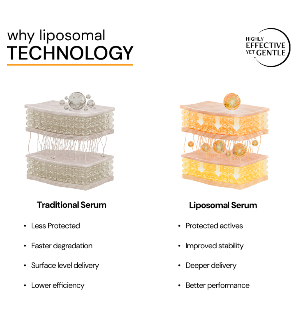 Liposomal technology