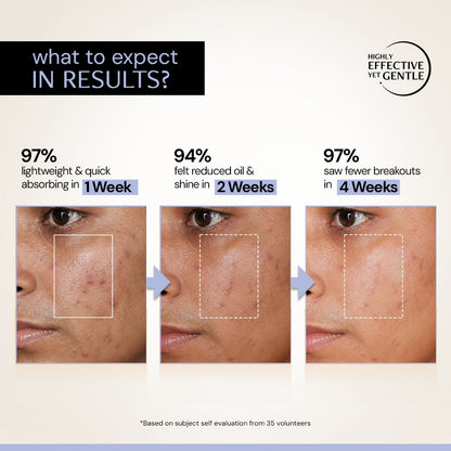 Oil Control Serum with 3% Niacinamide &amp; 2% Salicylic Acid With Liposomal Technology