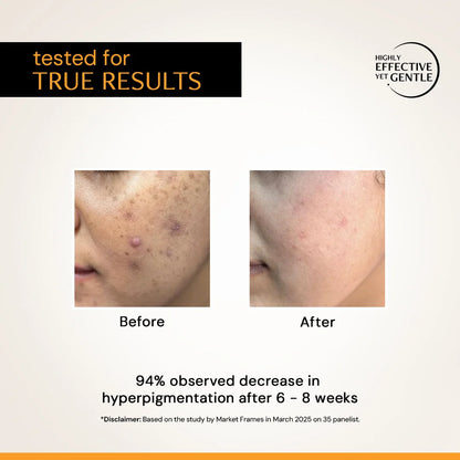 Before and after facial skin appearance showing gradual improvement over regular vitamin C serum use